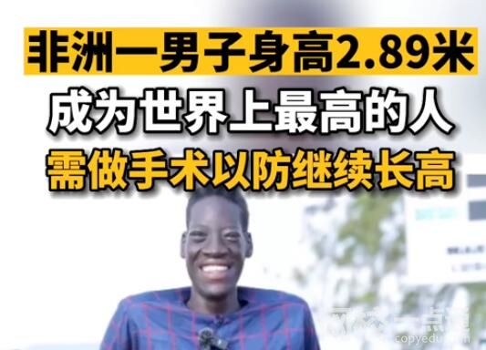 男子高2.89米成世界上最高的人 为什么这么高？