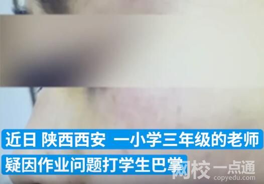 连扇学生数十耳光涉事老师被拘 内幕曝光简直太意外了