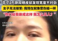 女子花2万割双眼皮控诉成了悲伤蛙 实在太悲剧了