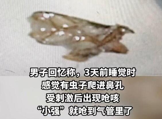 男子睡梦中蟑螂从鼻孔呛进气管 到底是什么情况？